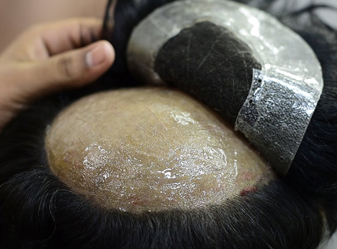 Hair Replacement Service